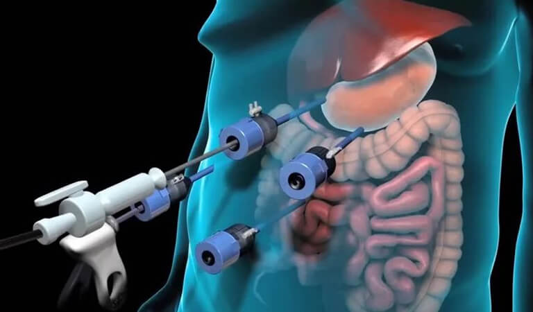 Medikal Animasyon – Nev Dijital Medya
